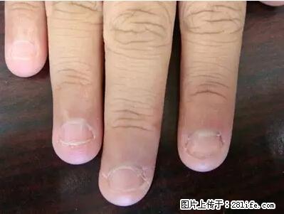 剪指甲、挖耳屎，这些日常小动作竟隐藏大危害！ - 张家界生活资讯 - 张家界28生活网 zjj.28life.net